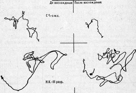 Кривые равновесия у альпинистов различной квалификации до и после скального восхождения III категории трудности